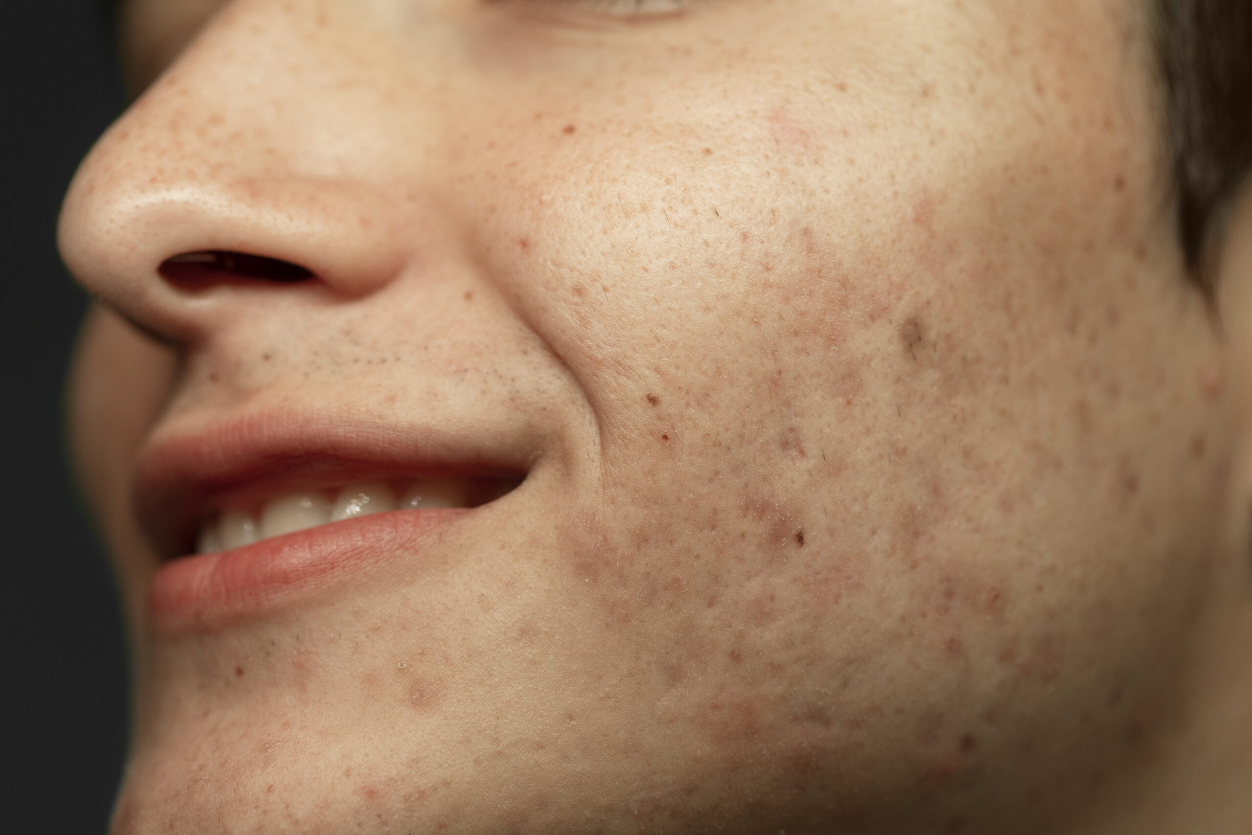 side-view-smiley-man-skin-texture