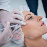 Woman receiving botox injection at clinic